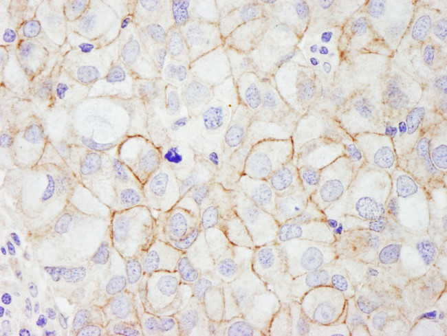 ErbB2 Antibody in Immunohistochemistry (Paraffin) (IHC (P))