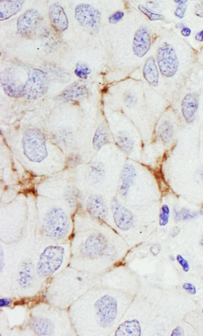ErbB2 Antibody in Immunohistochemistry (Paraffin) (IHC (P))