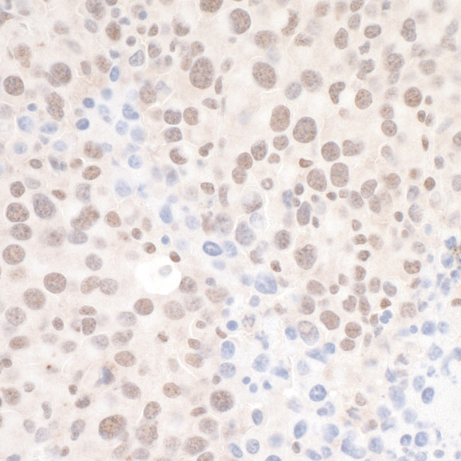DHX8 Antibody in Immunohistochemistry (Paraffin) (IHC (P))