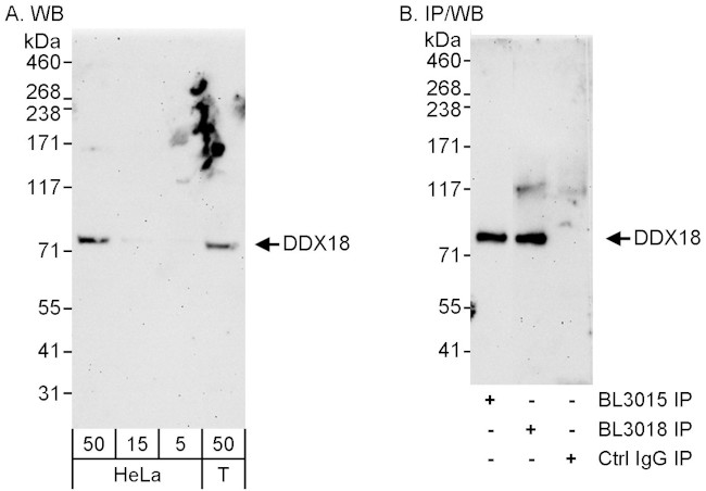 DDX18 Antibody in Western Blot (WB)