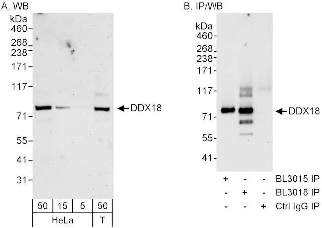 DDX18 Antibody in Western Blot (WB)