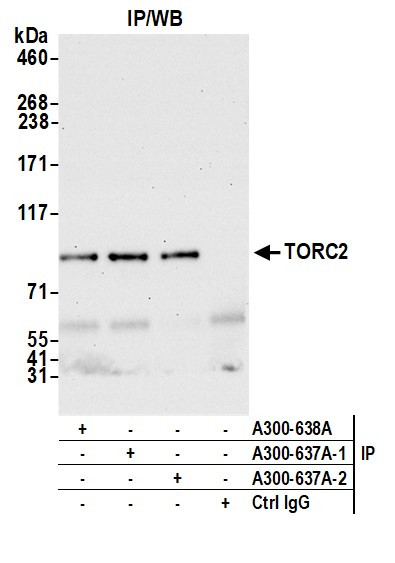 TORC2 Antibody in Immunoprecipitation (IP)