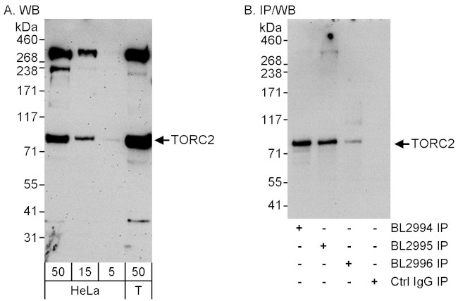 TORC2 Antibody in Western Blot (WB)