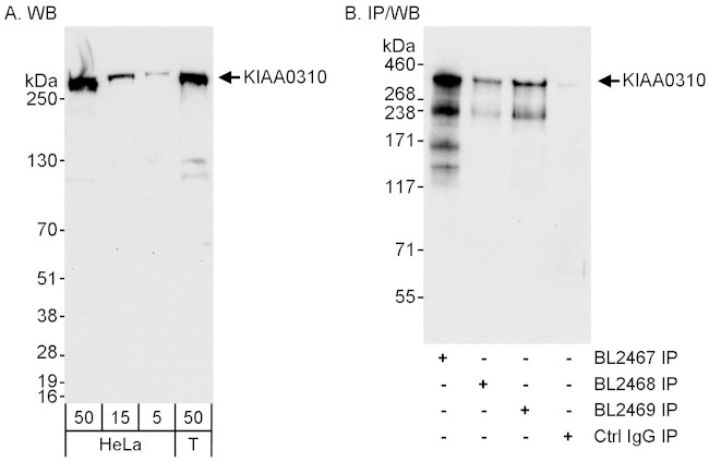 KIAA0310 Antibody in Western Blot (WB)