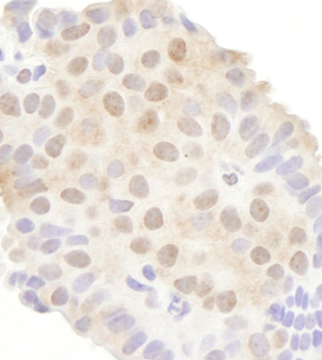 DDX20 Antibody in Immunohistochemistry (Paraffin) (IHC (P))