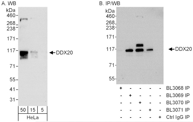 DDX20 Antibody in Western Blot (WB)