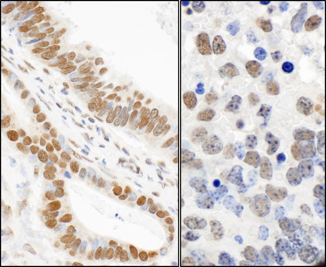 Phospho-53BP1 (Ser25) Antibody in Immunohistochemistry (Paraffin) (IHC (P))