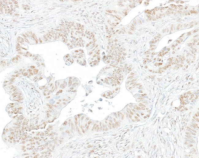 Phospho-RNA Polymerase II (Ser2) Antibody in Immunohistochemistry (Paraffin) (IHC (P))