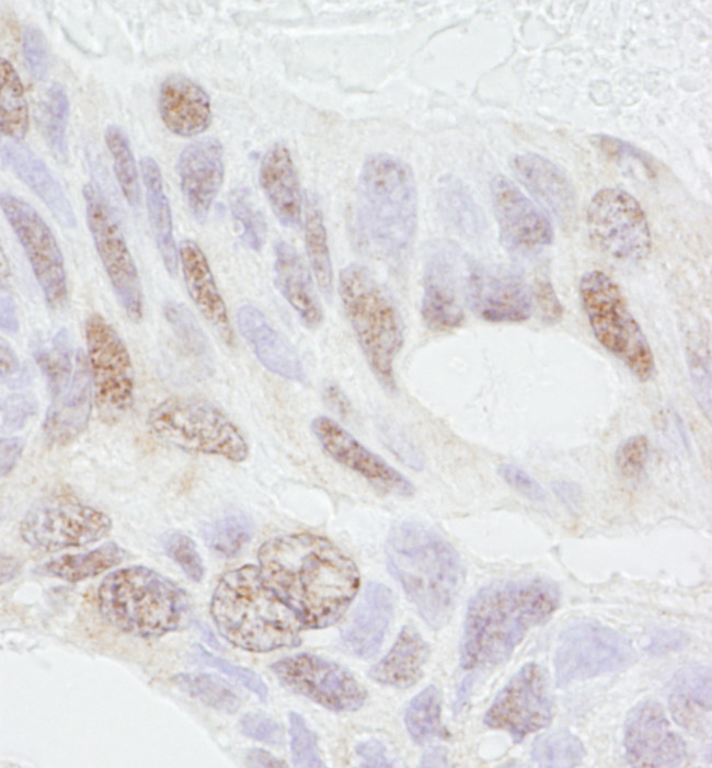 REA Antibody in Immunohistochemistry (Paraffin) (IHC (P))