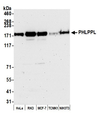 PHLPPL Antibody in Western Blot (WB)