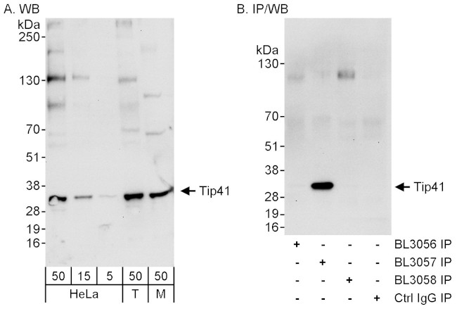 Tip41 Antibody in Western Blot (WB)