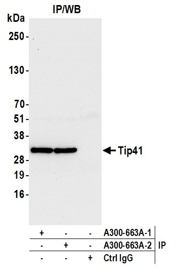 Tip41 Antibody in Immunoprecipitation (IP)