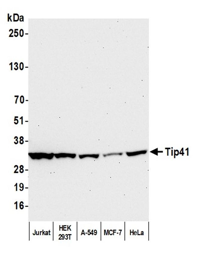 Tip41 Antibody in Western Blot (WB)