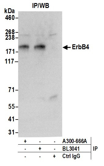 ErbB4 Antibody in Immunoprecipitation (IP)