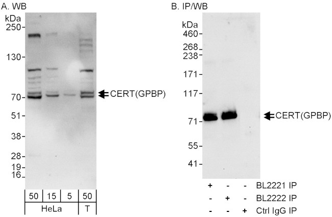 CERT/GPBP Antibody in Western Blot (WB)