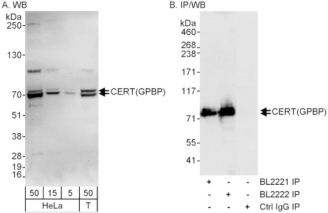 CERT/GPBP Antibody in Western Blot (WB)