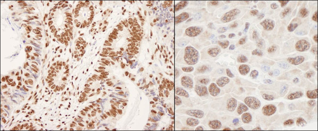 hnRNP-K Antibody in Immunohistochemistry (Paraffin) (IHC (P))