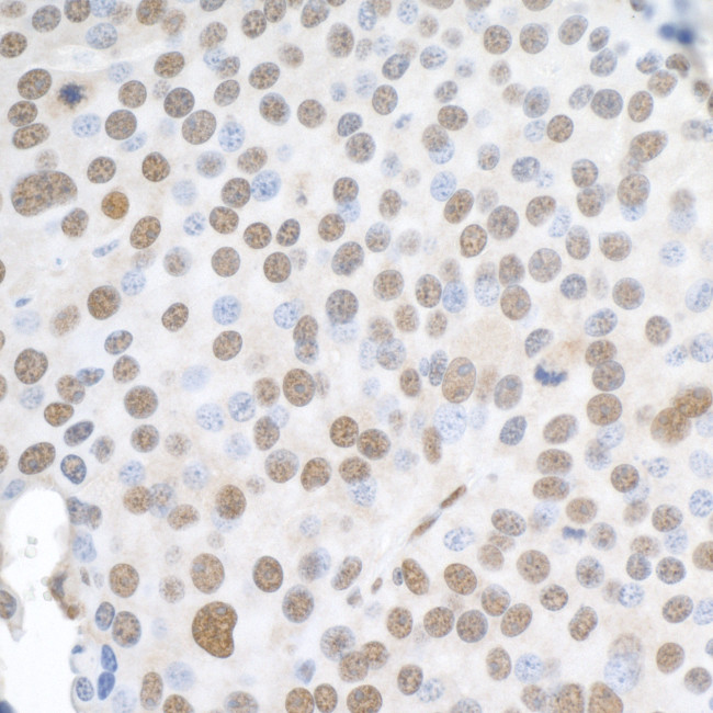 hnRNP-K Antibody in Immunohistochemistry (Paraffin) (IHC (P))