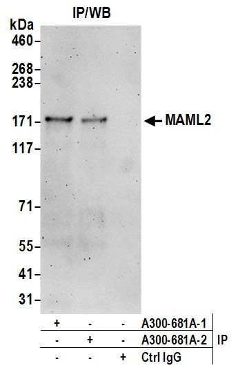 MAML2 Antibody in Immunoprecipitation (IP)