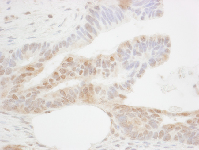 CDX2 Antibody in Immunohistochemistry (Paraffin) (IHC (P))