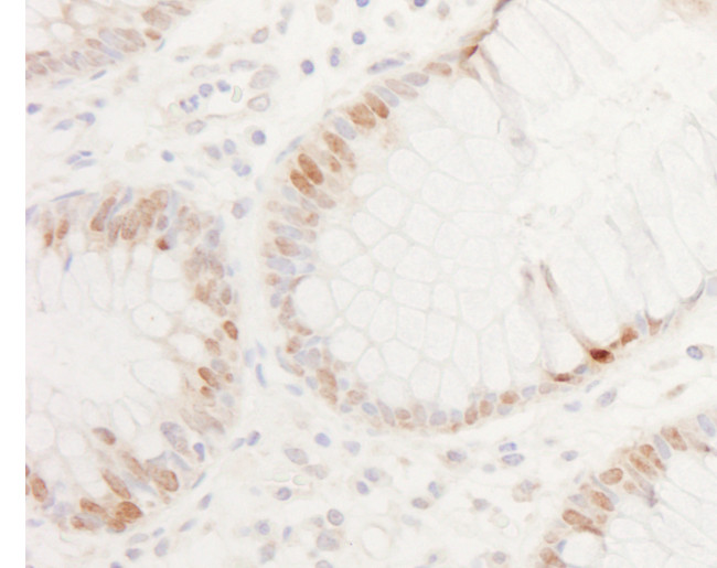 CDX2 Antibody in Immunohistochemistry (Paraffin) (IHC (P))