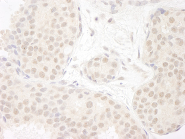 DDX23 Antibody in Immunohistochemistry (Paraffin) (IHC (P))