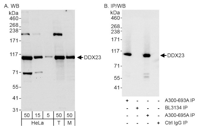 DDX23 Antibody in Western Blot (WB)