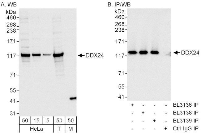 DDX24 Antibody in Western Blot (WB)