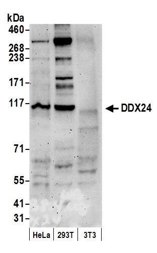 DDX24 Antibody in Western Blot (WB)
