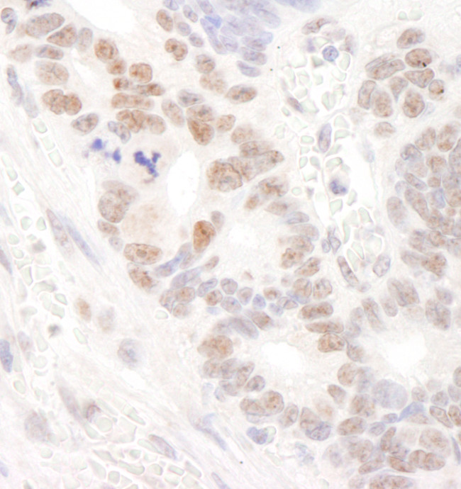 DDX24 Antibody in Immunohistochemistry (Paraffin) (IHC (P))