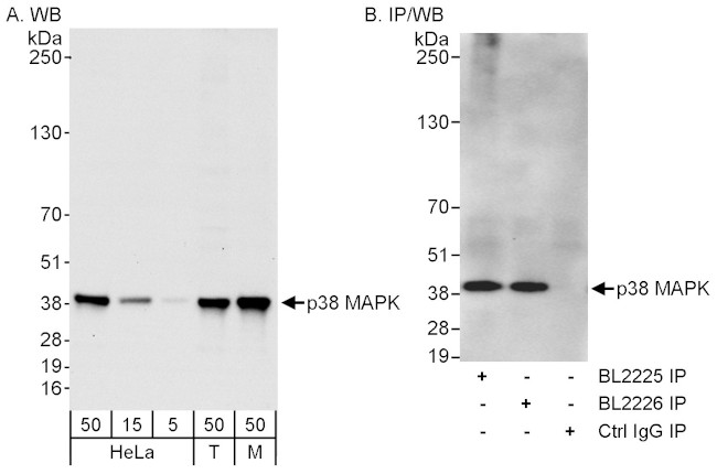 p38 MAPK Antibody in Western Blot (WB)