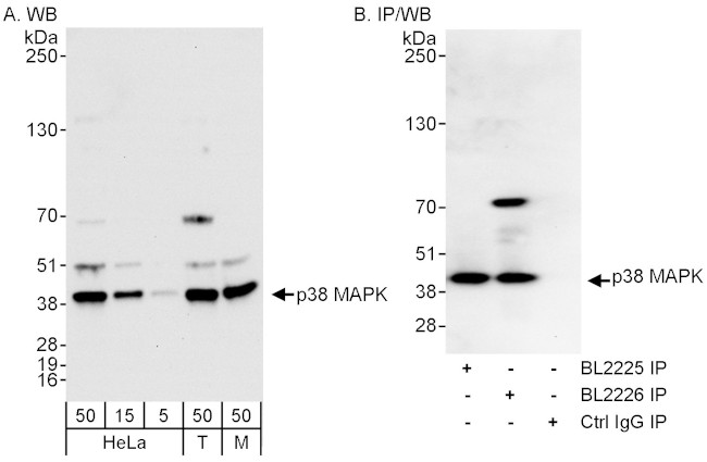 p38 MAPK Antibody in Western Blot (WB)