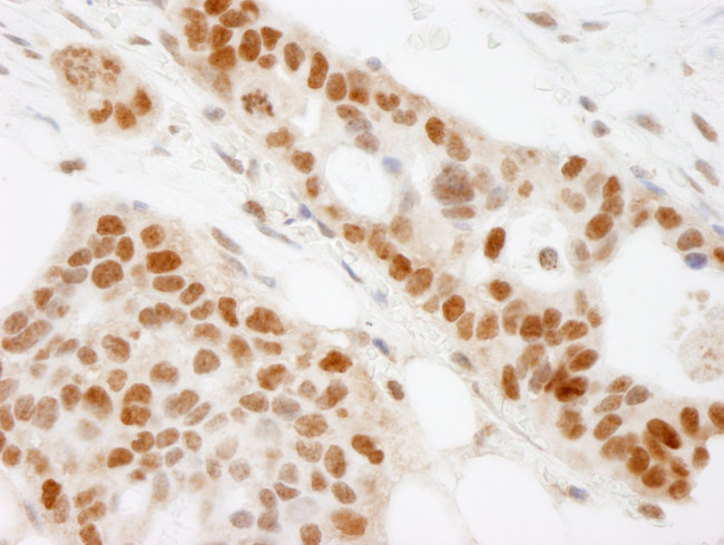 BAAT1 Antibody in Immunohistochemistry (Paraffin) (IHC (P))