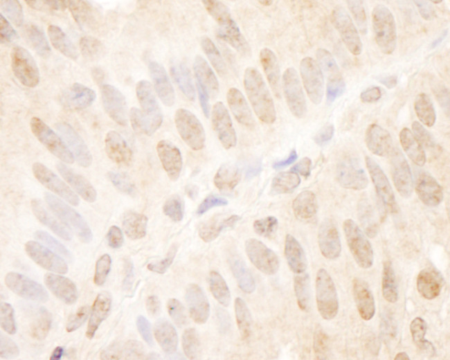 TCF12 Antibody in Immunohistochemistry (Paraffin) (IHC (P))