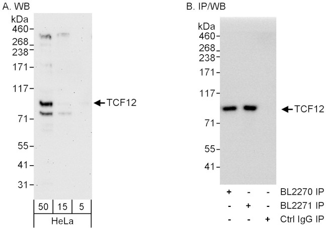 TCF12 Antibody in Western Blot (WB)