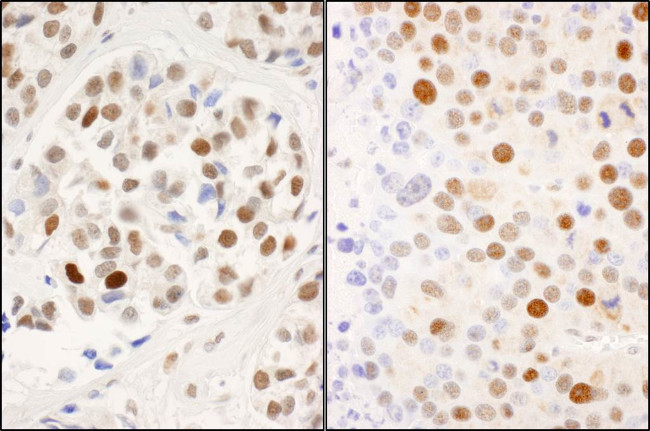 Phospho-MCM2 (Ser53) Antibody in Immunohistochemistry (Paraffin) (IHC (P))