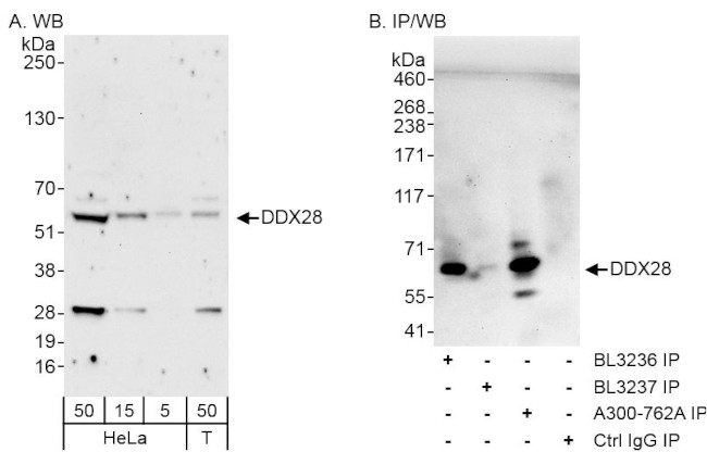 DDX28 Antibody in Western Blot (WB)