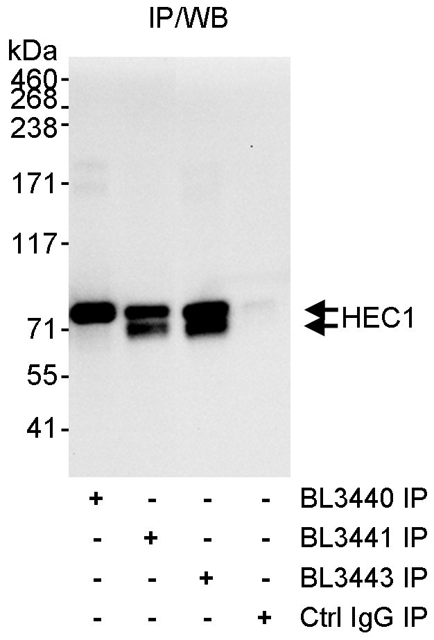 HEC1 Antibody in Immunoprecipitation (IP)