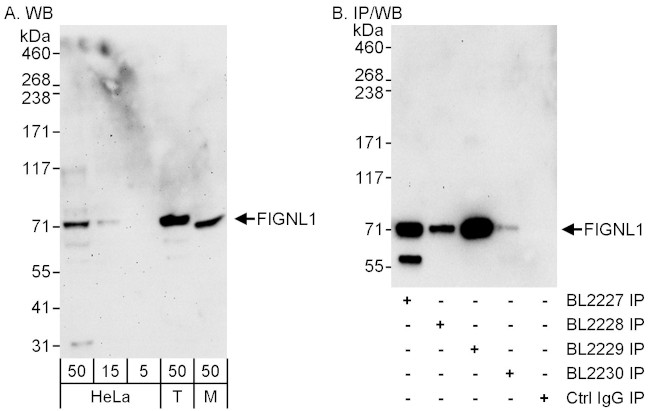 FIGNL1 Antibody in Western Blot (WB)
