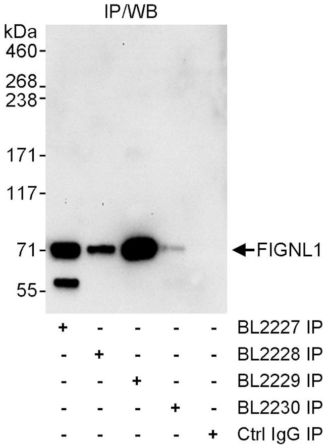 FIGNL1 Antibody in Immunoprecipitation (IP)