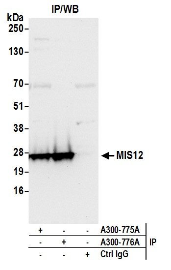 MIS12 Antibody in Immunoprecipitation (IP)