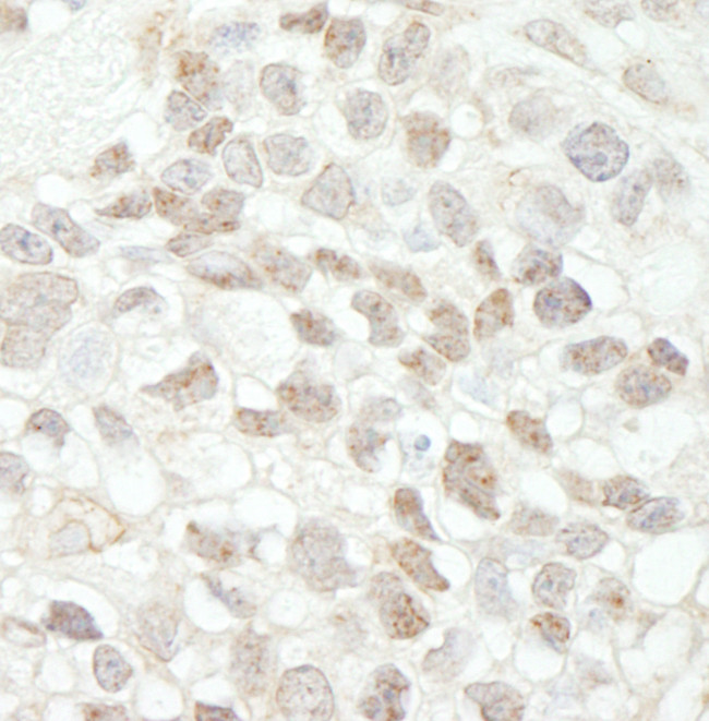 MED18 Antibody in Immunohistochemistry (Paraffin) (IHC (P))