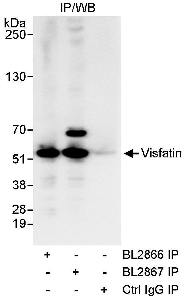 Visfatin Antibody in Immunoprecipitation (IP)