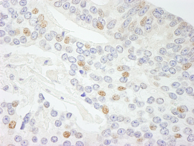 NCOA5/CIA Antibody in Immunohistochemistry (Paraffin) (IHC (P))