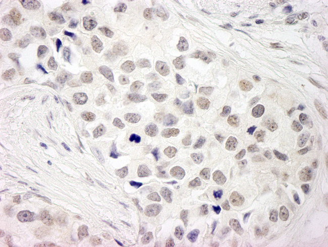 NCOA5/CIA Antibody in Immunohistochemistry (Paraffin) (IHC (P))