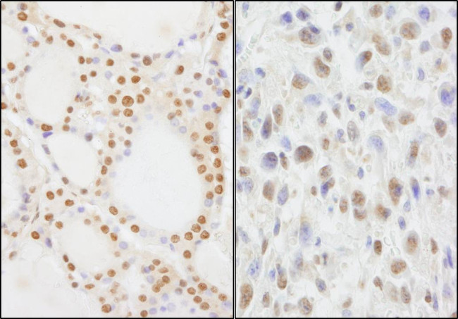 NIF1 Antibody in Immunohistochemistry (Paraffin) (IHC (P))