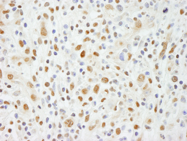 NIF1 Antibody in Immunohistochemistry (Paraffin) (IHC (P))