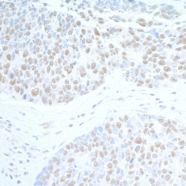 SUPT6H Antibody in Immunohistochemistry (Paraffin) (IHC (P))