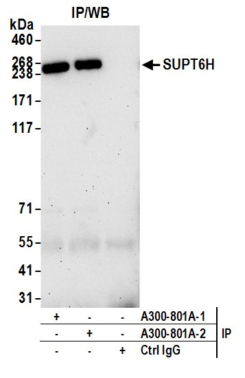 SUPT6H Antibody in Immunoprecipitation (IP)