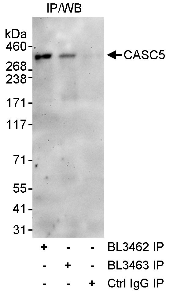 CASC5 Antibody in Immunoprecipitation (IP)